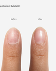 Vitamin-C Cuticle Oil