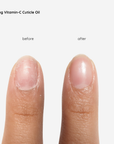 Vitamin-C Cuticle Oil